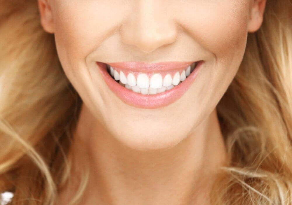 I tried teeth contouring and it changed my smile and my self-confidence